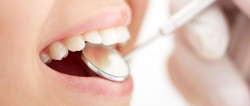 Mit dem Zahnarzt zu weißen Zähnen